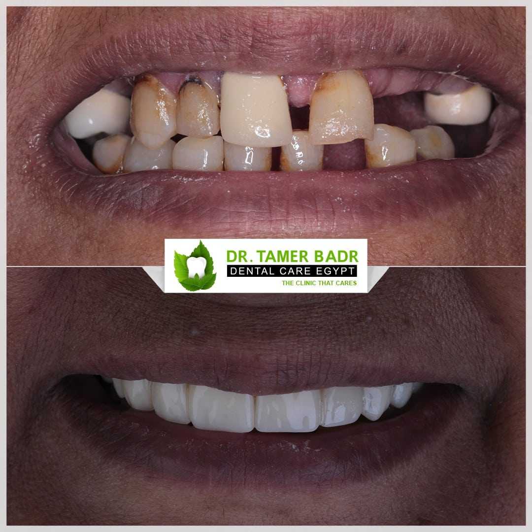 Dintal-Implant-Dr-2