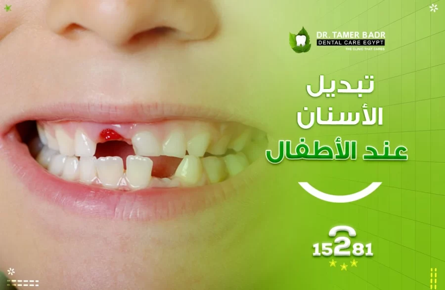 تبديل الأسنان عند الأطفال