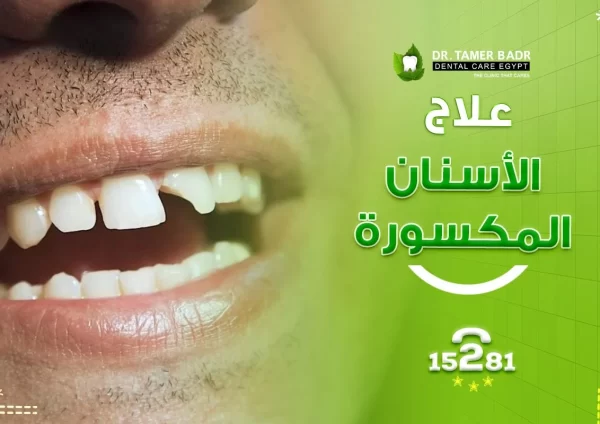 علاج الاسنان المكسورة