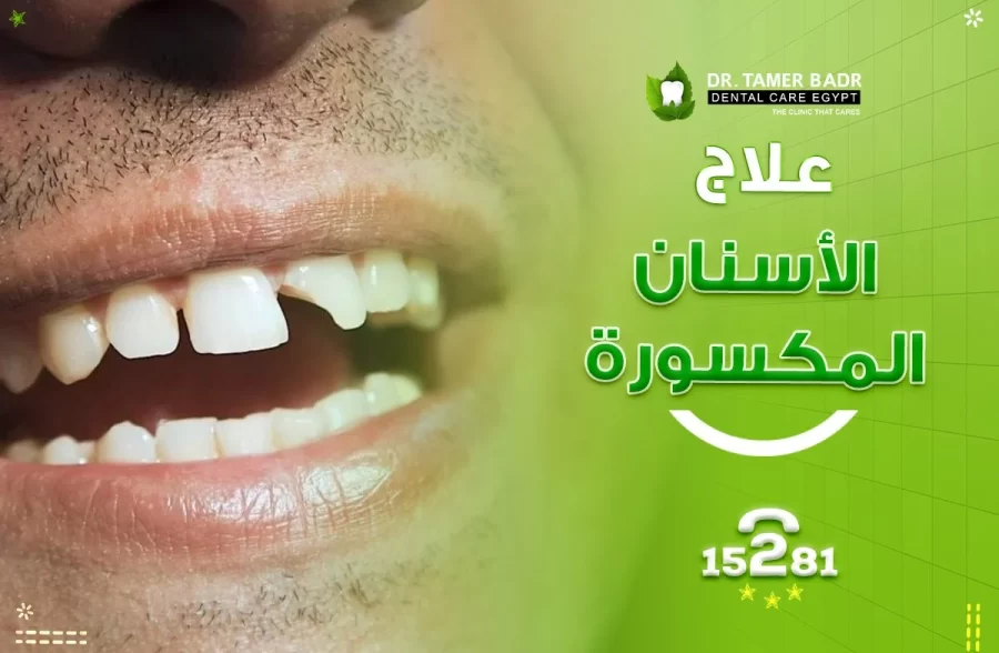 علاج الاسنان المكسورة