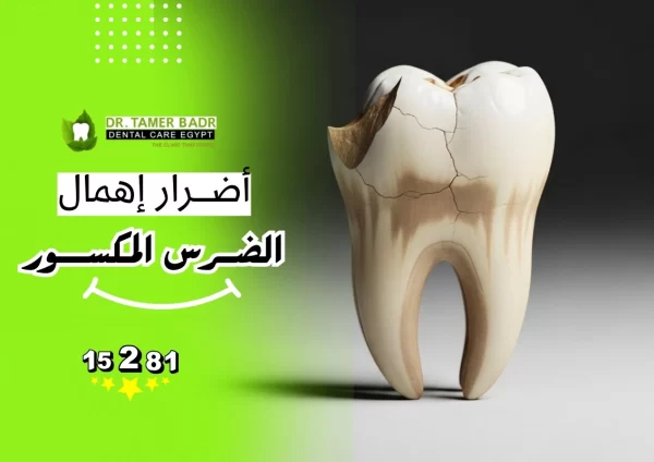 أضرار إهمال الضرس المكسور