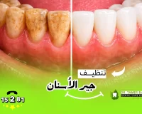 هل تنظيف جير الاسنان يسبب ضعف الأسنان؟ وما هو عدد الجلسات المناسب؟