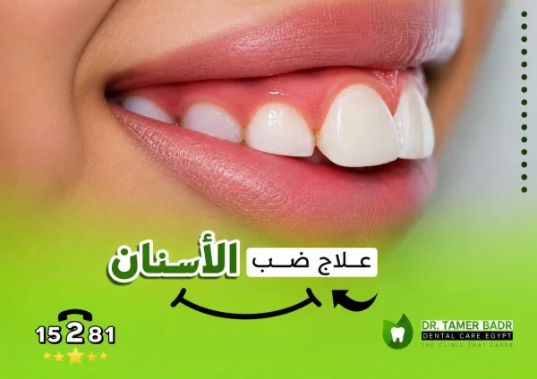 ضب الأسنان