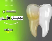 تجميل الاسنان لا يقتصر علي الفينيرز والتركيبات!