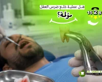 هل عملية خلع ضرس العقل مؤلمة؟ الحقيقة كاملة!