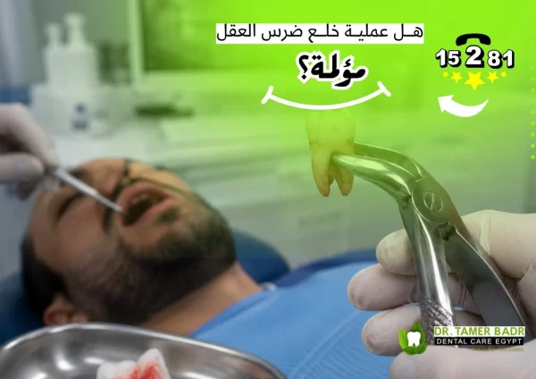 هل عملية خلع ضرس العقل مؤلمة