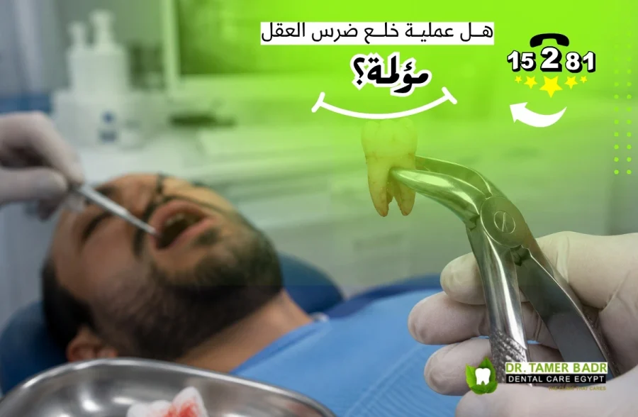 هل عملية خلع ضرس العقل مؤلمة