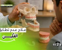 تعرف علي أهم طرق علاج عدم تطابق الفكين والأعراض والأسباب الشائعة