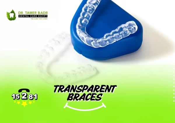 transparent braces