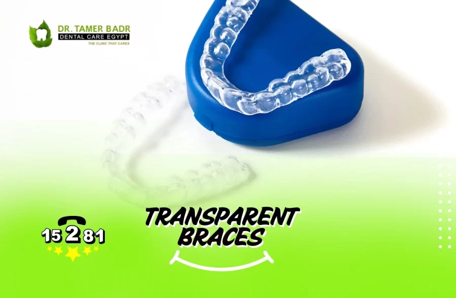transparent braces